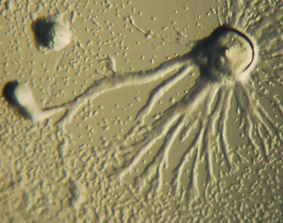 mold testing under microscope